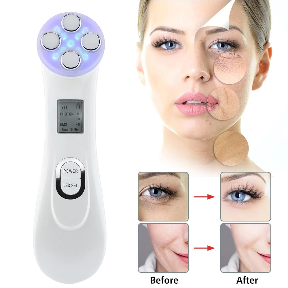 5 Colors EMS Face Beauty Device Microcurrent Red Blue Green Yellow Light Therapy IPL S