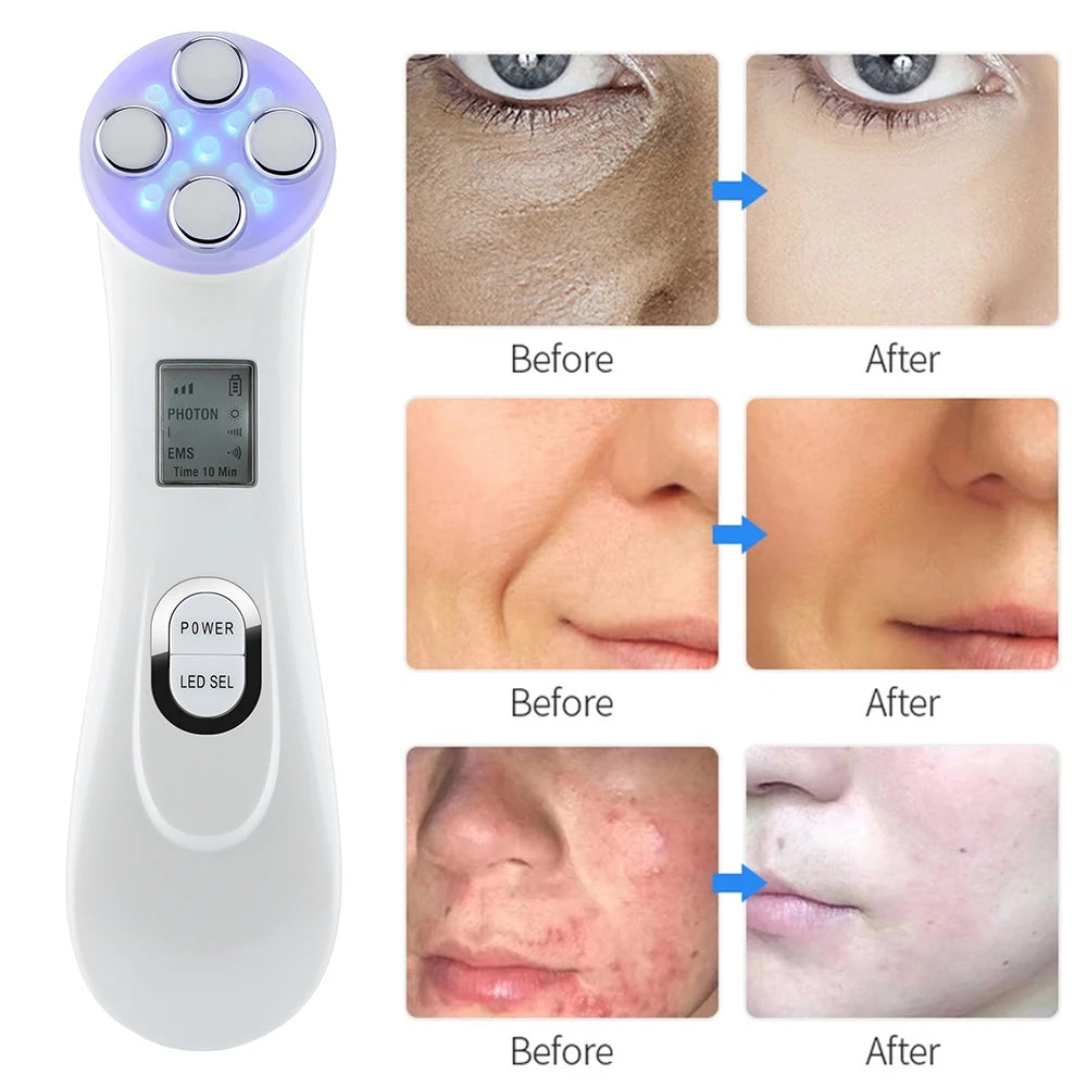 5 Colors EMS Face Beauty Device Microcurrent Red Blue Green Yellow Light Therapy IPL S